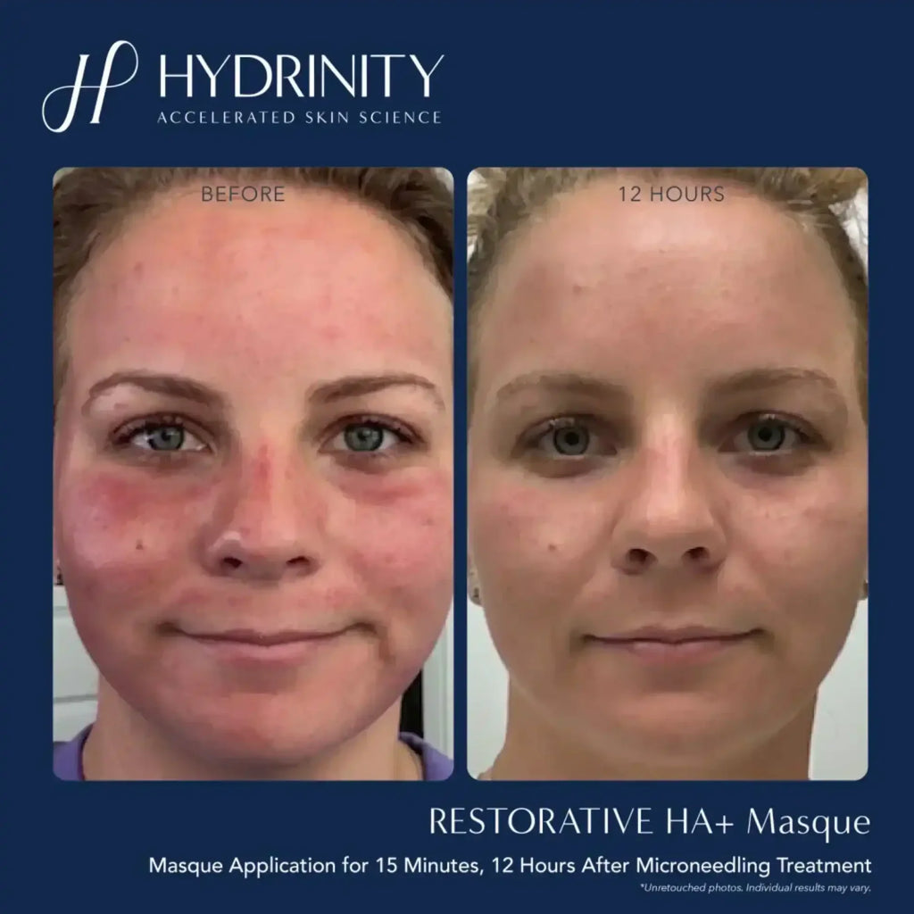 Hydrinity Restorative HA Serum 30ml 醫美級修復透明質酸精華 補水舒緩鎮靜 醫美療程後