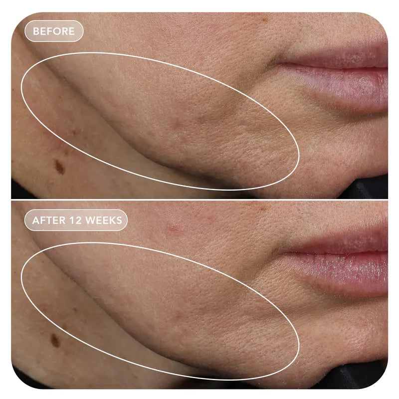 IMAGE Skincare VOL.U.LIFT GLP-1 4D Skin Rebound Complex 57ml 4D逆齡緊緻霜 凹陷肌救星