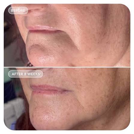 IMAGE Skincare VOL.U.LIFT GLP-1 4D Skin Rebound Complex 57ml 4D逆齡緊緻霜 凹陷肌救星