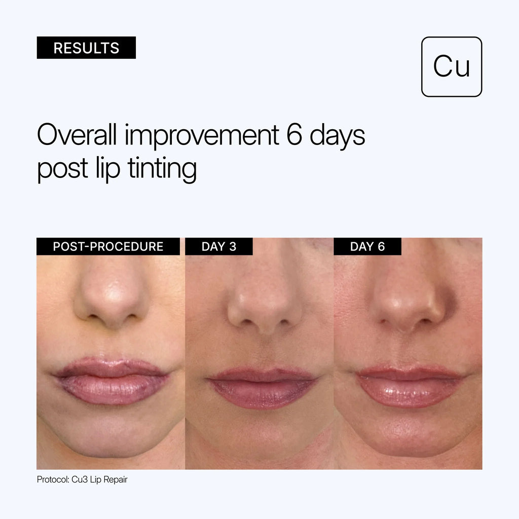 NEOVA Cu3 Lip Repair with Copper Peptide Complex  妮歐瓦 藍銅勝肽唇部修護精華 高效保濕修護護唇膏 15 ml 舒緩龜裂醫美術後