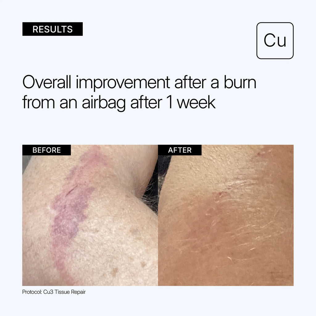 Neova CU3 Tissue Repair Recovery cream/Lotion with copper peptide complex NEOVA Cu3 Tissue Repair Recovery Cream 60ml專為雷射微針化學煥膚或微創手術後臨床級修復乳液/乳霜