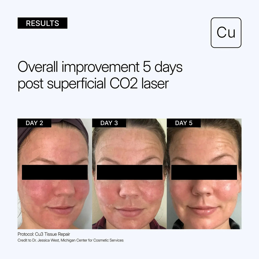 Neova CU3 Tissue Repair Recovery cream/Lotion with copper peptide complex NEOVA Cu3 Tissue Repair Recovery Cream 60ml專為雷射微針化學煥膚或微創手術後臨床級修復乳液/乳霜