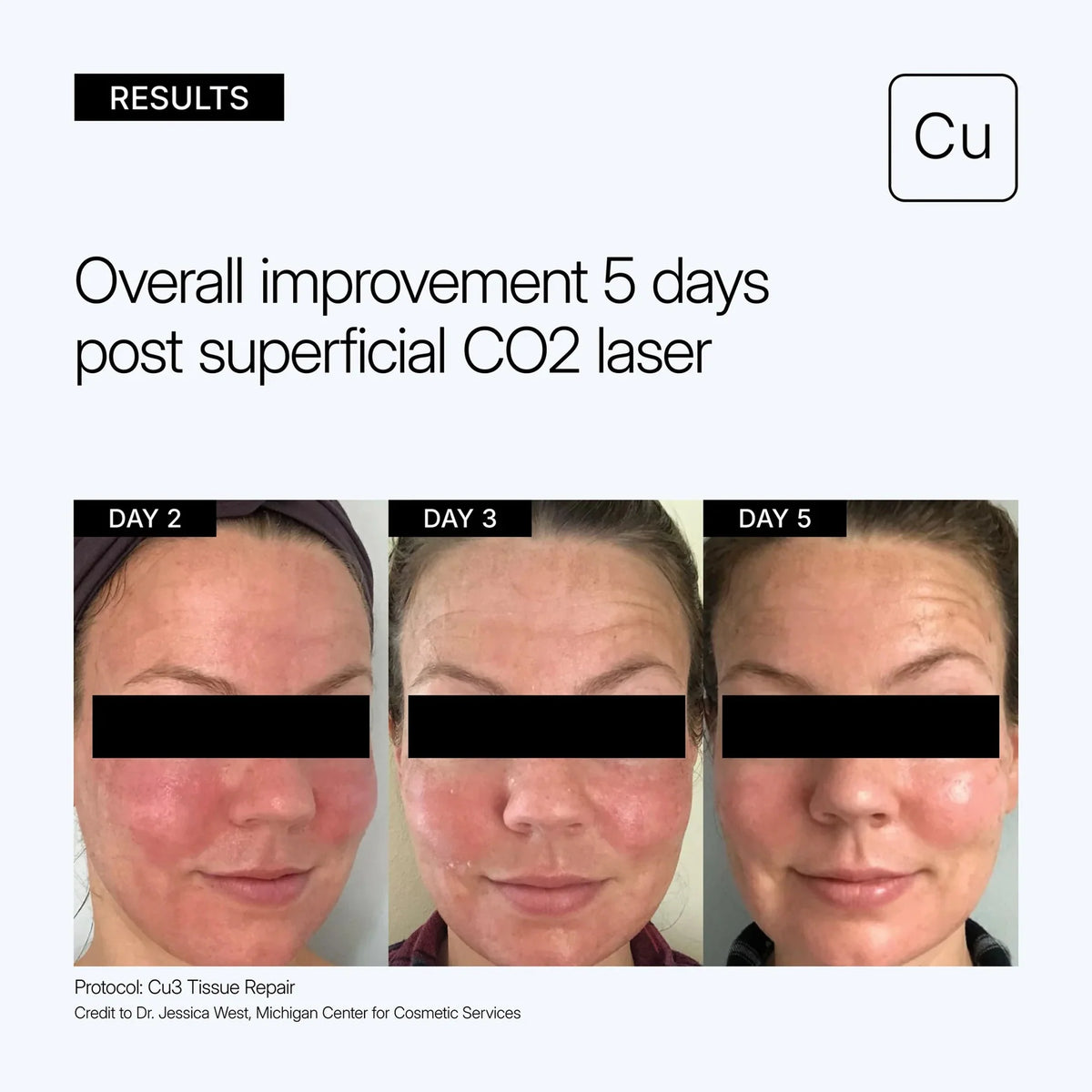 Neova CU3 Tissue Repair Recovery cream/Lotion with copper peptide complex NEOVA Cu3 Tissue Repair Recovery Cream 60ml專為雷射微針化學煥膚或微創手術後臨床級修復乳液/乳霜