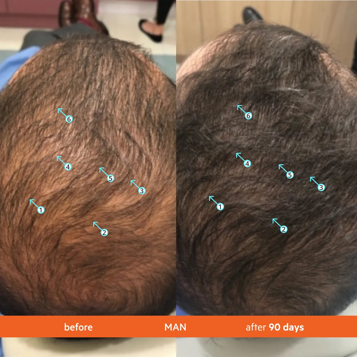 DS Laboratories Revita Tablets Hair Growth Supplement 口服生髮防脫髮營養補充品 3o粒 毛囊營養 對抗荷爾蒙壓力減少掉髮