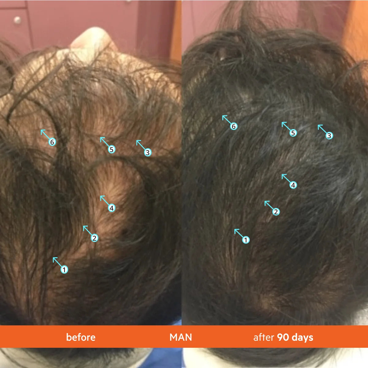 DS Laboratories Revita Tablets Hair Growth Supplement 口服生髮防脫髮營養補充品 3o粒 毛囊營養 對抗荷爾蒙壓力減少掉髮