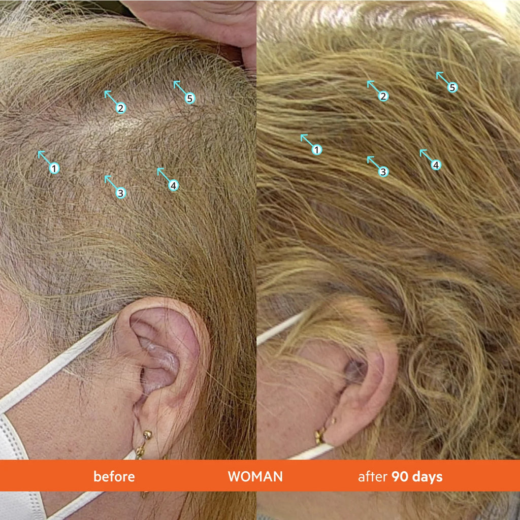 DS Laboratories Revita Tablets Hair Growth Supplement 口服生髮防脫髮營養補充品 3o粒 毛囊營養 對抗荷爾蒙壓力減少掉髮
