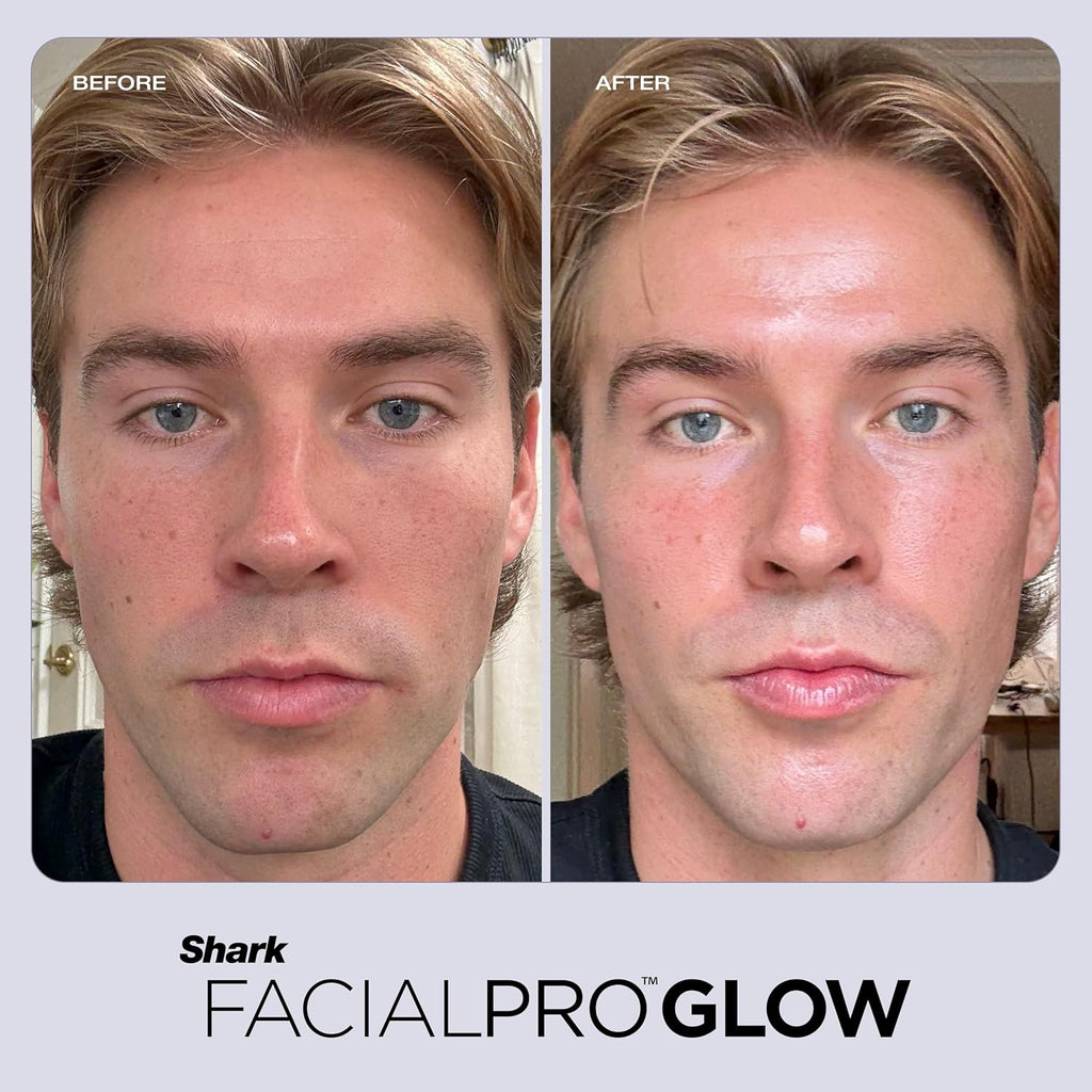 Shark FacialPro Glow+ DePuffi 二合一美容儀(冷熱療法) 10分鐘打造專業級居家煥膚體驗