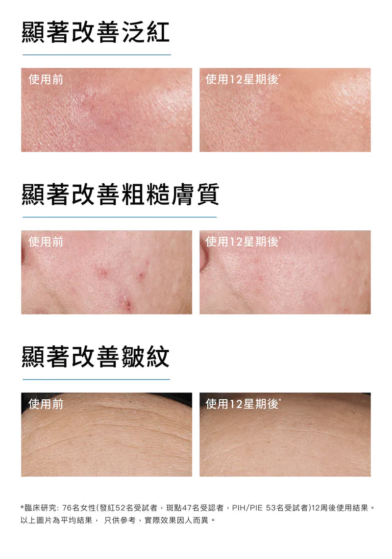 SkinCeuticals Advanced RGN-6 50ml 6維再生修復面霜50ml 舒緩抗氧