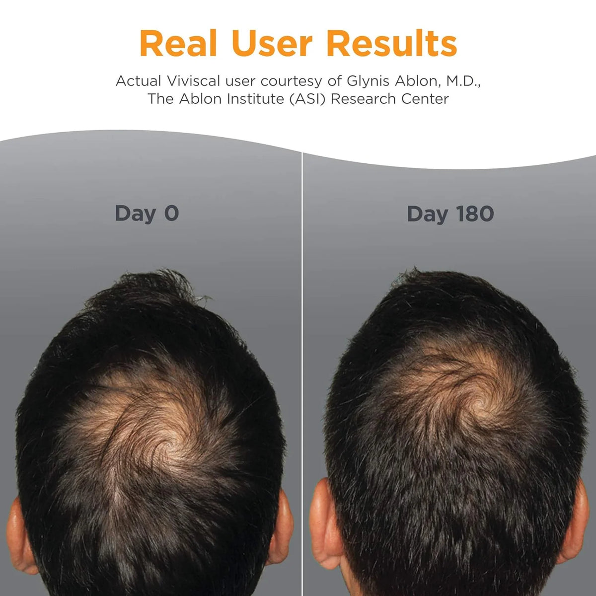 Viviscal Man Hair Growth Supplements 男用頭髮生長營養補充 防脫髮生髮膠囊