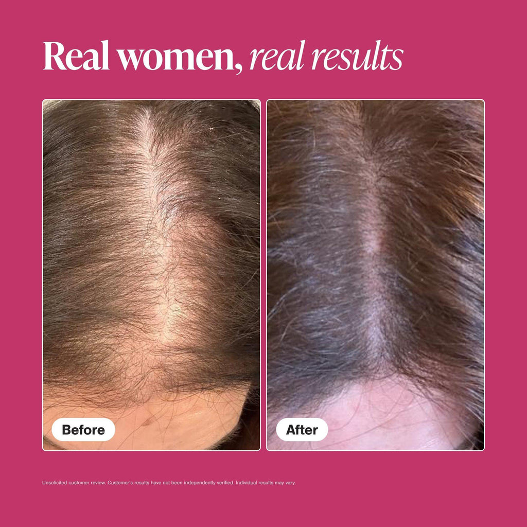 Viviscal Woman Hair Growth Supplement 女用頭髮生長營養補充膠囊60粒