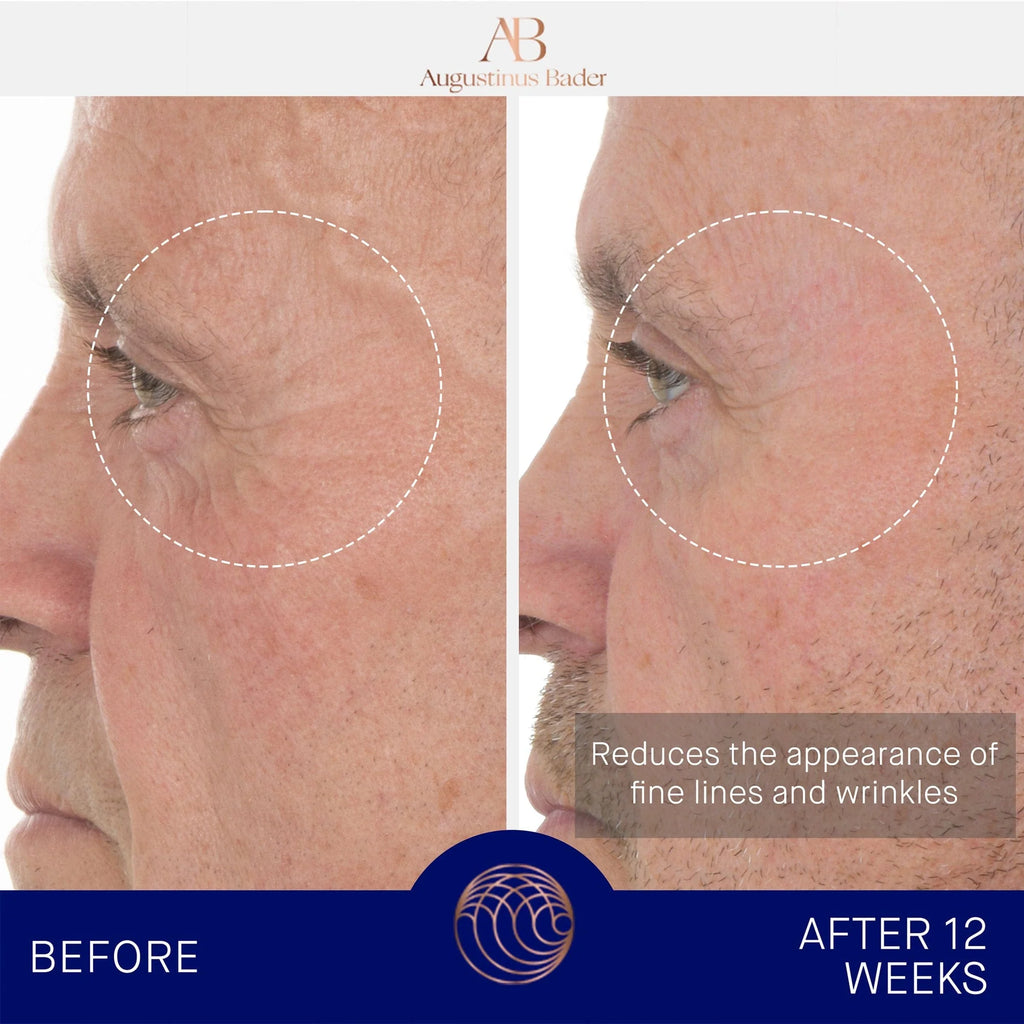 Augustinus Bader The Retinol Serum 30ml 賦能生機視黃醇精華液 藍鑽抗皺精華