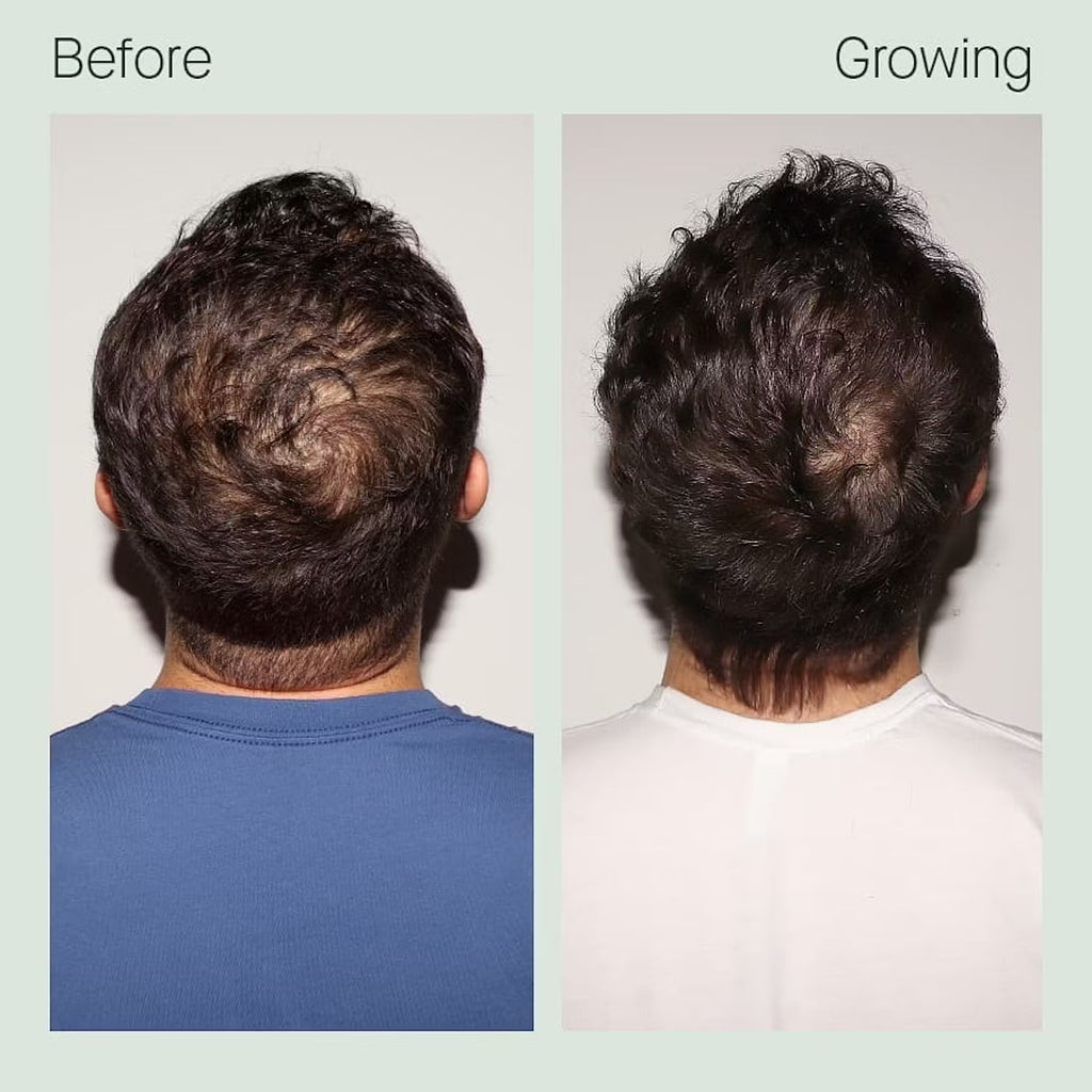 章小蕙推薦 Nutrafol 男士生髮補充劑 經臨床證明可增稠頭髮 120粒 Hair Growth
