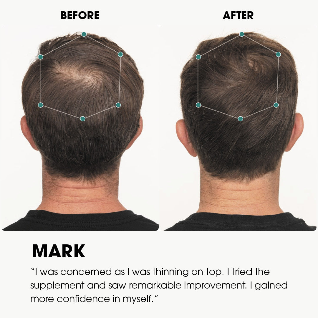 章小蕙推薦 Nutrafol 男士生髮補充劑 經臨床證明可增稠頭髮 120粒 Hair Growth