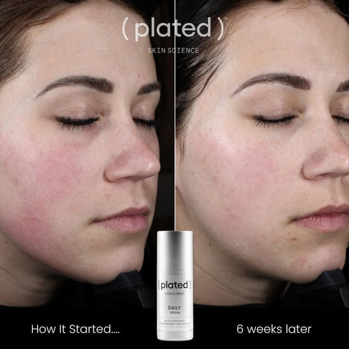 (plated) Skin Science DAILY Serum 30ml 外泌體抗氧修護日常精華