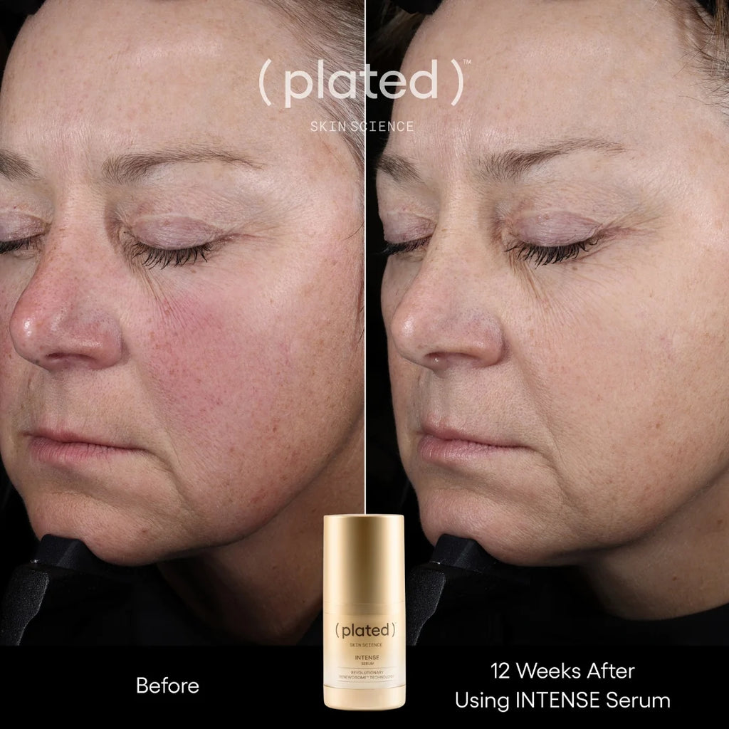 (plated) Skin Science INTENSE Serum 15ml 血小板外泌體精萃 強效精華素