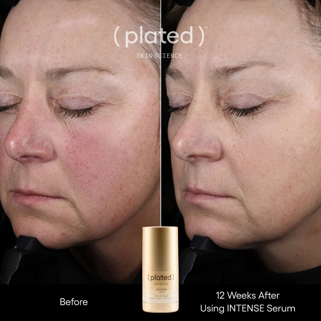 (plated) Skin Science INTENSE Serum 15ml 血小板外泌體精萃 強效精華素