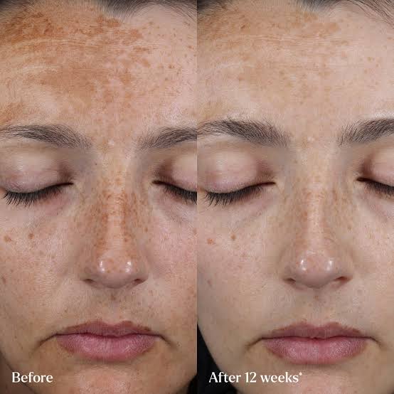 Skin Rocks The Hyperpigmentation Serum 淡斑濃縮修護精華30ml 針對黑斑 紅斑 曬斑 黃褐斑 痘印